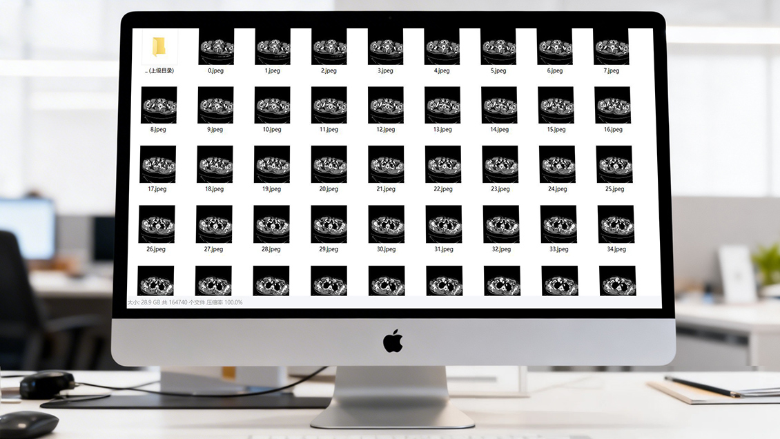 超过16万组CT/彩超/MRI医疗影像数据集 医学模型训练 深度学习 人工智能AI训练数据包