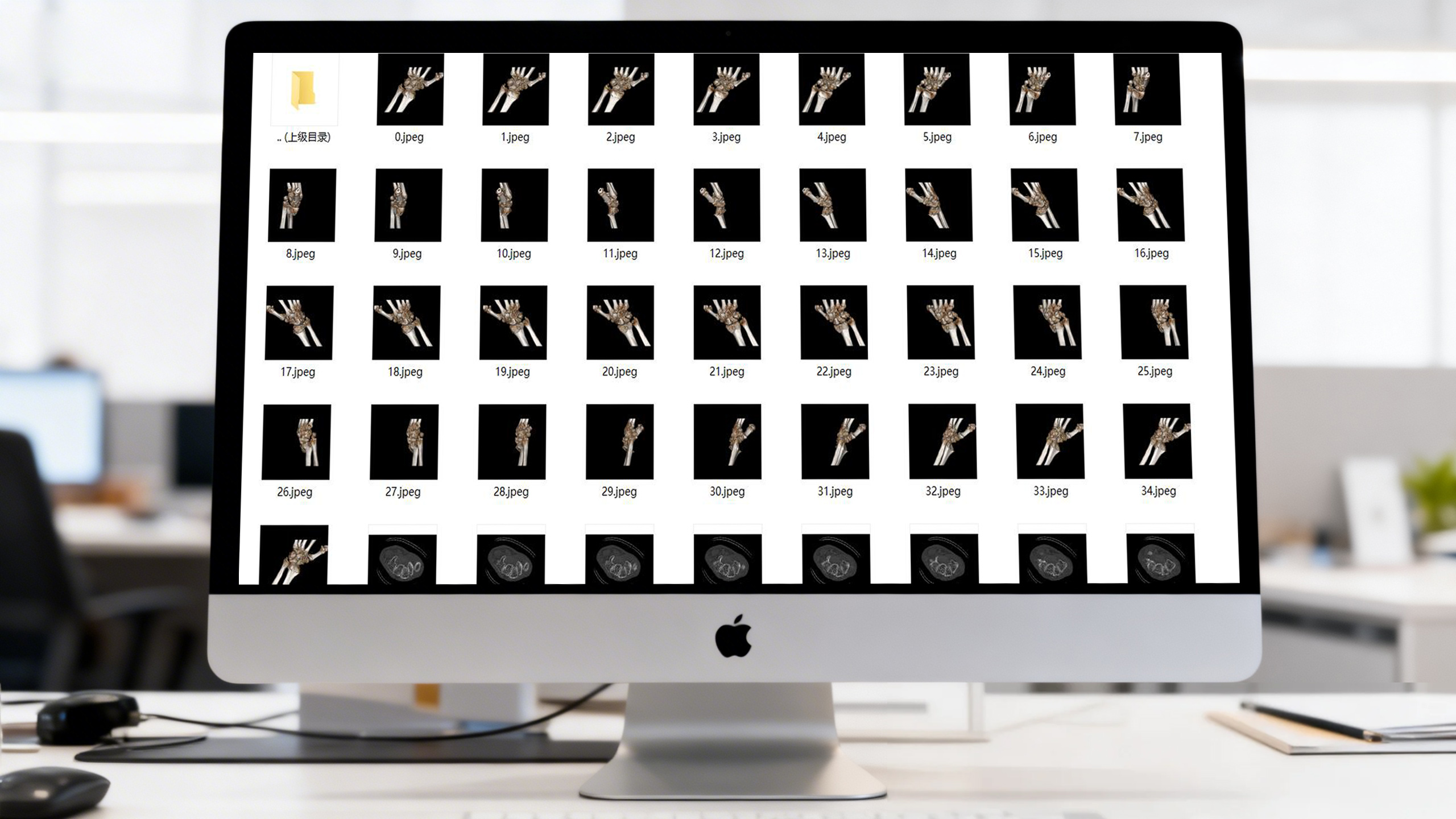 165682万组医疗影像CT/彩超/MRI数据集 医学模型训练 深度学习 人工智能AI训练数据包