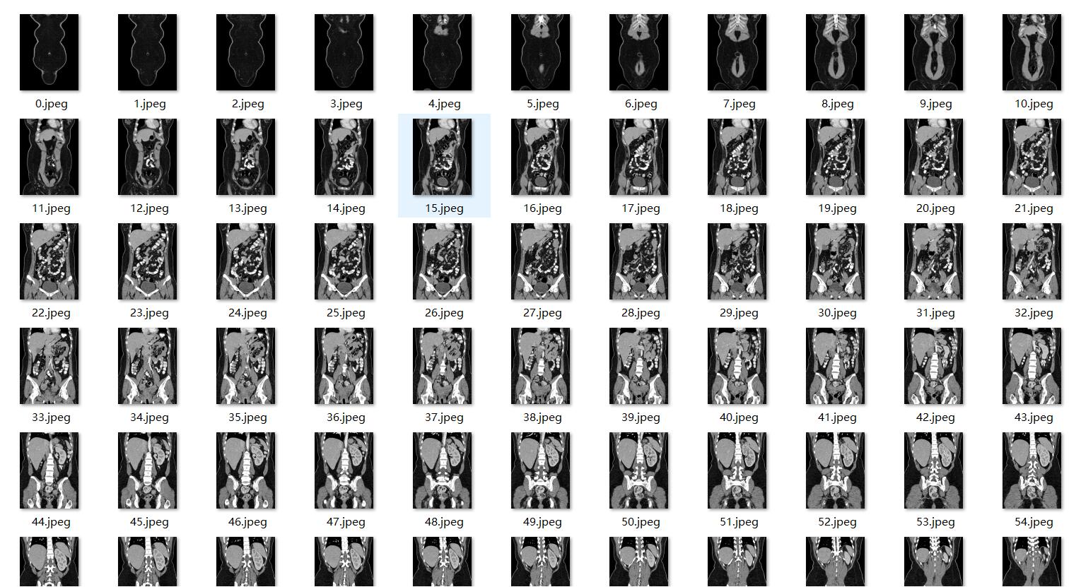 28GB医疗模型训练数据【医疗影像】CT/彩超/MRI多模态数据【第四期】